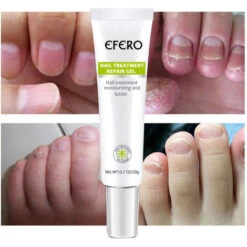 Crema Per La Cura Delle Unghie Anti-cocente 20g 9 Crema Per La Cura Delle Unghie Anti-cocente 20g -Cibi per gatti Italia 76873562 3