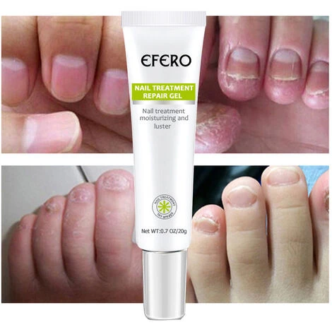 Crema Per La Cura Delle Unghie Anti-cocente 20g 5 Crema Per La Cura Delle Unghie Anti-cocente 20g - immagine 3