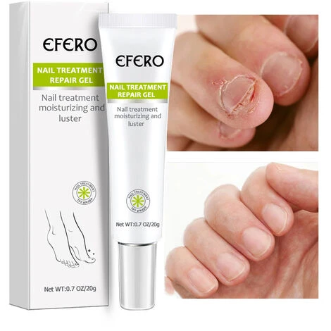 Crema Per La Cura Delle Unghie Anti-cocente 20g 7 Crema Per La Cura Delle Unghie Anti-cocente 20g - immagine 5